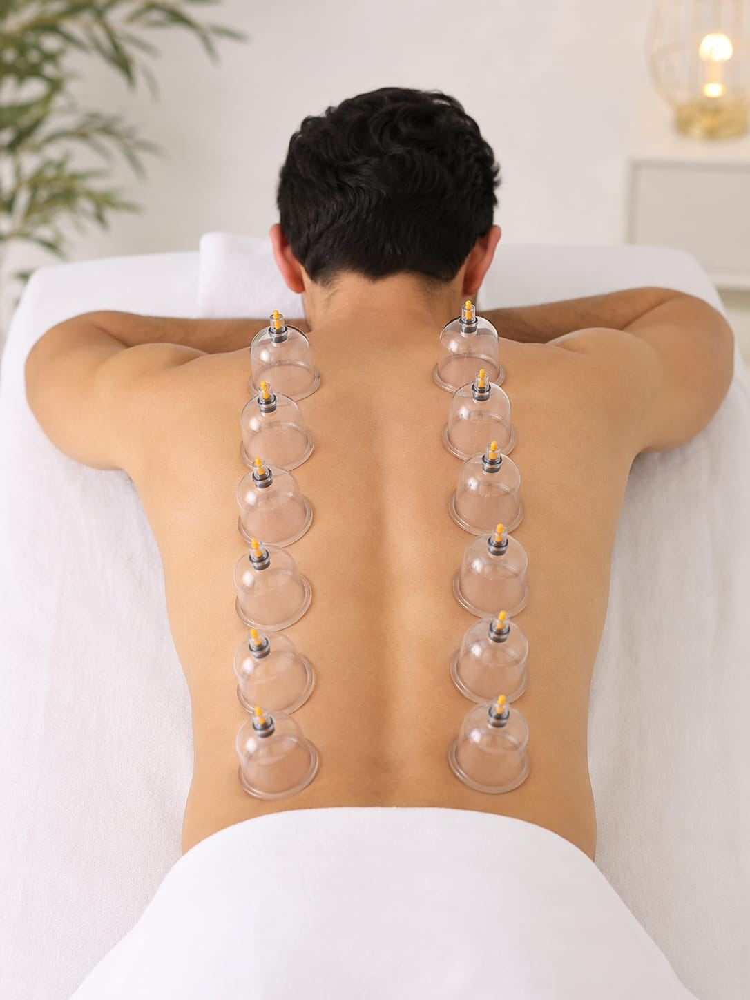 Cupping Therapy (Hijama)